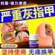樂(lè )雅妮芙林鹽酸阿莫羅芬搽劑正品灰指甲特有效藥專(zhuān)用指甲真菌感染國藥準字指甲增厚發(fā)黃變厚變空重度灰指甲特治效藥 1盒本品【灰指甲專(zhuān)用藥】