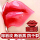 唇膜貼片去死皮淡化唇紋嘴唇嘴膜改善唇周邊暗沉發(fā)黑去黑色素 升級款1盒裝（20片）