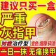 灰指甲100%專(zhuān)用的藥視覺(jué)特效重度灰指甲藥膏指甲真菌感染脫甲壞甲亮甲增厚發(fā)黃變厚變空根藥治硝酸咪康唑乳膏 1盒裝【建議多盒用藥 發(fā)貨特效】重度灰指甲