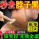 TVLV脖子黑色素去除黑棘皮癥治黑脖子病克星肘部腋下黑皮去黑專(zhuān)用膏藥 多維美白透亮嫩膚頸霜