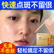點(diǎn)斑藥水去雀斑老年斑點(diǎn)斑專(zhuān)用美容院同款取斑美容金水 點(diǎn)完就掉