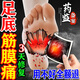 喬記足跟痛專用腳后跟疼痛足底筋膜炎膏藥貼腳底板后跟腱骨刺脹痛正品 1盒貼體驗裝【發(fā)貨特效快】 足底筋膜炎(100%發(fā)貨特效)貼膏