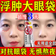 紅霉素眼膏去眼袋消除重度眼袋專(zhuān)用女男士黑眼圈重度去除專(zhuān)用藥眼霜淡化細紋提拉緊致黑眼圈眼袋眼紋去除神器 1盒【紅霉素軟藥膏去眼袋】