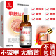 妙丹堂甲溝炎專用消腫去肉芽指甲長肉里根手腳嵌甲息肉除矯正器治非藥膏 一盒裝