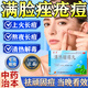 清熱暗瘡丸祛痘痘粉刺痘印醫用痤瘡中藥去青春痘紅腫硬疙瘩痘印消炎膿皰去痘印青少年痤瘡專(zhuān)用藥【視覺(jué)特效】 1盒【國藥正品】標準裝