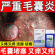 毛囊炎專(zhuān)用特專(zhuān)效藥頭皮癢止癢毛囊炎頭部專(zhuān)用藥二硫化硒洗劑醫用毛囊炎脂溢性皮炎馬拉色菌毛囊炎脫發(fā)掉皮屑 3盒周期裝【國藥準字】長(cháng)效保護頭皮