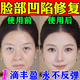 臉部凹陷填充液膠原蛋白太陽穴淚溝眼窩凹陷填充神器面部修復精華 單瓶裝【修復臉凹陷】 30ml