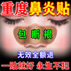 秋雅奈緒鼻炎鼻貼過(guò)敏性鼻竇炎蒼耳子專(zhuān)用兒童成人治根鼻塞鼻癢穴位貼神器 買(mǎi)3贈2【鞏固裝】永久不犯膏藥貼 蒼耳子鼻炎鼻甲肥大腺樣體打噴嚏