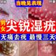 尖銳濕疣特新強效藥男女士尖銳濕疣私處專(zhuān)用菜花狀疣去疣專(zhuān)用藥治療濕疣hpv扁平疣的特正品效藥維A酸乳膏 1盒裝【濕疣專(zhuān)效藥】無(wú)痛祛除 早用早好