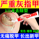 揚子洲灰指甲特亮效藥專(zhuān)用指甲真菌感染脫甲國藥準字重度灰指甲專(zhuān)用京東大藥房指甲增厚發(fā)黃變厚變空硝酸咪康唑乳膏 1盒【建議多盒用藥】灰指甲專(zhuān)用藥膏