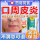 口周皮炎軟膏兒童成人嘴巴周?chē)l(fā)炎起皮起泡紅斑濕疹口角炎皮癬嘴角開(kāi)裂爛疼痛真菌感染過(guò)敏修護專(zhuān)用軟膏 1盒裝【體驗裝】