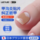 LUCYLEE日本甲溝炎器貼片腳指甲長(cháng)肉里專(zhuān)用正甲貼片甲溝嵌甲器趾甲工具 100貼【無(wú)痛矯正 不再扎肉】