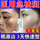 維a酸乳膏祛斑用藥臉部?jì)日{祛斑去斑去黑色素去黃褐斑用藥臉部女士可搭美白祛斑白霜淡化去雀斑產(chǎn)品內服外用 1盒裝淡化斑點(diǎn)國藥認證