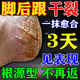 腳后跟干裂起硬皮足跟開(kāi)裂腳裂膏腳后跟干裂開(kāi)裂真菌感染腳干燥足后跟開(kāi)裂脫皮防裂膏手足干裂硝酸咪康唑乳膏 1盒【腳后跟干燥開(kāi)裂脫皮膏】