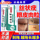 眼皮上肉粒長(cháng)小疙瘩輔助去除藥眼皮上的絲狀疣眼睛瞼周?chē)馄近S疣 眼皮上肉粒長(cháng)小疙瘩絲狀疣扁平黃疣通用