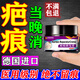 去疤痕修復凝膠醫院專(zhuān)用去除疤膏手術(shù)縫針新舊疤痕增生凸起去疙瘩 德國進(jìn)口強效型【1盒裝】疤痕修復除疤膏 疤克星祛疤痕藥膏靈醫用硅酮疤痕凝膠兒童面部剖腹產(chǎn)