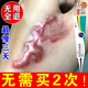 喬記去疤痕修復(fù)凝膠醫(yī)院專用祛疤膏修復(fù)新舊疤痕靈去除增生疙瘩凸起藥 1盒裝【無試用買贈(zèng)】 疤克祛疤膏手術(shù)縫針疤痕修復(fù)祛疤痕專用修復(fù)兒童硅酮