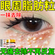 脂肪粒去除藥膏神器眼部專(zhuān)用眼霜消除汗管瘤脂肪油脂粒粟丘疹克星 一盒-一抹祛除