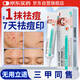 DR.JOINTNA祛痘膏青春去痘祛痘淡化印痘坑痤瘡粉刺專(zhuān)用學(xué)生少年