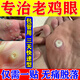 雞眼貼去i根去無(wú)痛脫落京東自家營(yíng)肉刺刺猴無(wú)痛脫落連根藥拔跖疣雞眼去除特膏貼效藥皮膚用藥水楊酸苯酚貼膏 1盒【去除雞眼專(zhuān)用貼膏】