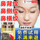 鼻背紋去除神器消除修復臉上鼻梁橫紋眉間抬頭橫行皺紋淡化山根皺紋祛額頭肌肉川字紋貼面霜 單盒體驗裝