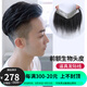 宜心 假發(fā)男高額頭前額發(fā)際線假發(fā)貼全真人發(fā)絲手織生物頭皮工藝 V型- 面積2.2*15發(fā)長 15cm