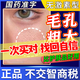 阿達(dá)帕林凝膠醫(yī)用祛痘消炎痤瘡專用青少年改善毛孔粗大醫(yī)用祛痘藥膏祛痘淡化痘印 1盒裝(不建議單拍)