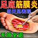 喬記本草足跟痛專用腳后跟疼痛足底筋膜炎膏藥貼腳底板后跟腱骨刺脹痛正品 1盒體驗裝（發(fā)貨特效快）