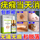 德傳公疣寧清扁平疣絲狀疣瘊子專用脖子上長小肉粒疙瘩猴子去除體疣藥膏 一盒裝【祛疣型】見效快 疣去神器疣體脫落膏點痣祛疣藥水