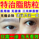 脂肪粒去除藥膏脂肪瘤專(zhuān)用特針效藥汗管瘤脂肪粒去除神器眼周專(zhuān)用去小顆粒脂肪粒專(zhuān)用特眼霜效藥維A酸乳膏 1盒【脂肪粒去除藥膏】100%國藥正品