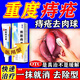 痔瘡膏去肉球內外混合痔瘡專(zhuān)用藥痔瘡藥去肉球出血止癢肛門(mén)瘙癢痣痔藥消腫醫用凝膠熊膽痔靈膏正品痔斷藥根 一盒【消痔專(zhuān)用 最好買(mǎi)多盒】