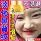 鼻背紋去除神器消除修復臉上鼻梁橫紋皺紋淡化山根褶皺紋祛額頭肌肉臉上鼻梁橫紋面霜貼 單盒體驗裝