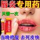 唇炎專(zhuān)用藥慢性唇炎嘴唇干裂醫用級嘴唇干裂脫皮唇炎潤唇膏兒童男女士上火嘴角起泡潰爛口角炎硝酸咪康唑乳膏 1盒裝【嘴唇干裂起皮唇炎】?jì)和扇硕歼m用 醫用級