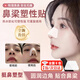熱塑鼻夾板自捏塑形瘦美鼻鼻梁增高變挺防摳鼻神器縮小矯正固定器 鼻夾板【膚色梯形】1個(gè)裝