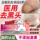 尤維佳維A酸乳膏醫用去黑頭閉口收縮毛孔 鼻子鼻頭粉刺清理 皮膚用藥祛痘消炎痤瘡草莓鼻男女士專(zhuān)用藥膏 1+1維生素b6軟膏 【醫用去黑頭】