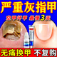 金歸環(huán)吡酮胺搽劑 灰指甲專(zhuān)用藥指甲真菌感染增厚發(fā)黃變厚變空治療重度灰指甲藥膏 正品【視覺(jué)特效】環(huán)吡酮胺乳膏 1+1溶液【雙效治效果極佳】快速去除 環(huán)吡酮胺搽劑