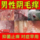 男人下體私處瘙癢止癢殺菌消炎克霉唑乳膏陰部瘙癢私處止癢軟膏男士陰部長(cháng)疙瘩毛囊炎紅腫疼痛長(cháng)痘痘真菌感染 1盒裝 專(zhuān)攻男性陰部瘙癢藥房直發(fā)