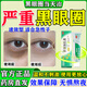 肝素鈉乳膏黑眼圈重度去除黑色素去黑眼圈專(zhuān)用藥眼部黑色素沉淀7000單位國藥準字皮膚用藥維a酸去黑眼圈 2盒 【重度 堅持10天 黑眼圈拜拜】