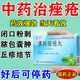 清熱暗瘡丸祛痘痘粉刺痘印 醫用痤瘡中藥去青春痘粉刺紅腫硬疙瘩痘印祛痘痘消炎膿皰去痘印青少年痤瘡專(zhuān)用藥 1盒【國藥OTC正品】