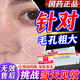 阿達帕林凝膠改善毛孔粗大去看黑頭醫用 祛痘消炎痤瘡專(zhuān)用青少年 正品臉上長(cháng)痘痘專(zhuān)用藥京東自官營(yíng)方旗艦店 1盒裝【國藥準字正品 毛孔粗大專(zhuān)用】