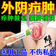 外陰癤腫火癤子拔毒軟膏陰部私處癢紅腫疼痛干裂長(cháng)膿包疙瘩毛囊炎藥專(zhuān)用 一盒裝【體驗裝】