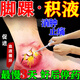 腳踝積液膏藥腳踝腫脹活血化瘀腳踝貼熱敷腳踝扭傷膏藥崴腳消腫止痛韌帶損傷專(zhuān)用藥消腫滑膜炎膏藥酮洛芬凝膠 1盒【腳踝積液專(zhuān)用藥】早抹早舒服