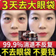 眼袋去除神器眼霜去大眼袋嚴重中老年男女士專(zhuān)用消除黑眼圈精華油 1瓶裝【當晚消眼袋】