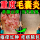 毛囊炎頭部藥頭皮癢脂溢性皮炎止癢真菌頭皮屑多感染皮膚用藥非處方克林霉素甲硝唑搽劑[視覺(jué)特效成人專(zhuān)用] 1盒【毛囊炎專(zhuān)用】