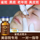YGYEU點(diǎn)斑藥水美容院專(zhuān)用不留疤去斑無(wú)痕美容院雀斑不留疤一擦就 一瓶【送修復液】 官正方品旗艦自大藥房營(yíng)
