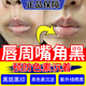 嘴唇黑色素去除唇周發(fā)黑改善唇周黑暗沉淡化唇紋角質(zhì)化黑色素沉淀去除提亮唇色滋潤唇部男女適用 買(mǎi)二送一【嘴唇黑色素沉淀】