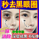 歐誘黑眼圈重度去除黑色素男女士眼貼膜眼霜淡化細紋提拉緊致眼袋眼紋 1盒裝【秒消黑眼圈】祛除黑色素沉淀 去黑眼圈專(zhuān)用眼部黑色素沉淀