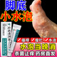 川石水泡型腳氣特新效期專(zhuān)用藥腳上起水泡癢汗皰疹止癢去真菌感染長(cháng)癢水泡腳氣藥止癢脫皮爛腳丫汗腳臭克霉唑乳膏 一盒裝【水泡型腳氣】