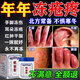 醫用蛇油凍瘡膏止癢疼痛耳朵臉部手指腳防凍皸裂紅腫專(zhuān)用凍傷膏藥 蛇油凍瘡膏【1瓶】