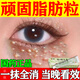 脂肪粒去除藥膏維A酸乳膏軟化角質(zhì)脂肪粒去除神器眼周專(zhuān)用去小顆粒脂肪粒專(zhuān)用特新效藥膏汗管瘤眼部專(zhuān)用去除 【單盒】眼角有肉粒 【國藥正品】特新效期藥